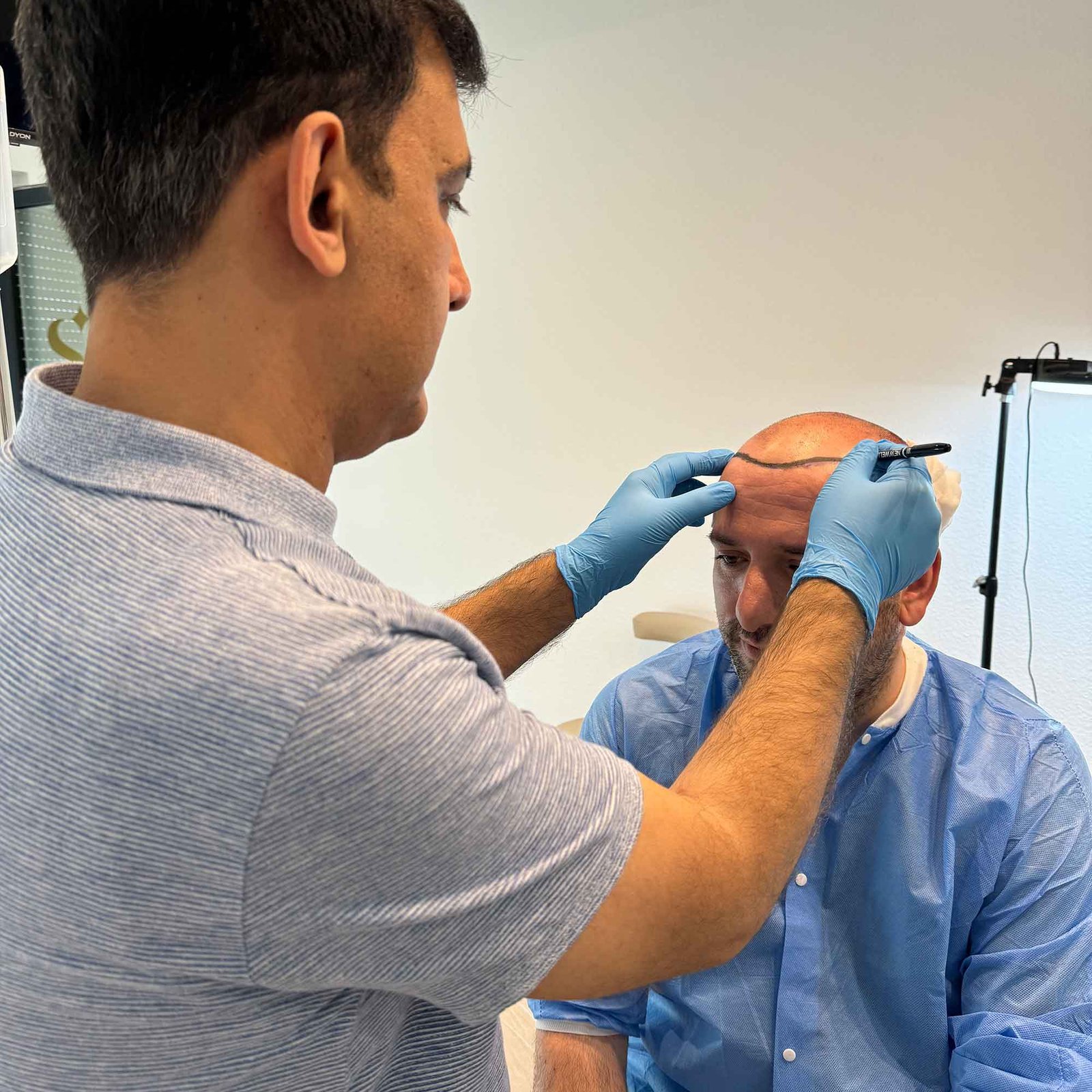 Haartransplantation Mannheim bei Staraesthetic – Vorher-Nachher-Ergebnisse